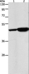 ENO2 / NSE Antibody - Western blot analysis of 293T and Jurkat cell, using ENO2 Polyclonal Antibody at dilution of 1:1250.