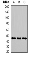 ENO2 / NSE Antibody - Western blot analysis of Gamma-enolase expression in HeLa (A); Jurkat (B); 293T (C) whole cell lysates.