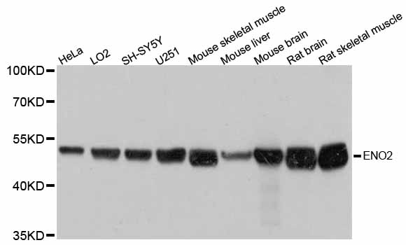 ENO2 / NSE Antibody - Western blot analysis of extracts of various cell lines, using ENO2 antibody at 1:3000 dilution. The secondary antibody used was an HRP Goat Anti-Rabbit IgG (H+L) at 1:10000 dilution. Lysates were loaded 25ug per lane and 3% nonfat dry milk in TBST was used for blocking. An ECL Kit was used for detection and the exposure time was 1s.