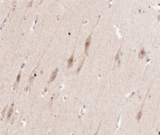 ENO2 / NSE Antibody - 1:100 staining human brain tissue by IHC-P. The tissue was formaldehyde fixed and a heat mediated antigen retrieval step in citrate buffer was performed. The tissue was then blocked and incubated with the antibody for 1.5 hours at 22°C. An HRP conjugated goat anti-rabbit antibody was used as the secondary.