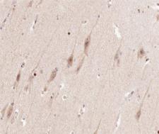 ENO2 / NSE Antibody - 1:100 staining human brain tissue by IHC-P. The tissue was formaldehyde fixed and a heat mediated antigen retrieval step in citrate buffer was performed. The tissue was then blocked and incubated with the antibody for 1.5 hours at 22°C. An HRP conjugated goat anti-rabbit antibody was used as the secondary.