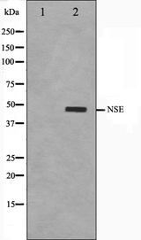 ENO2 / NSE Antibody - Western blot analysis on HepG2 cell lysates using NSE antibody. The lane on the left is treated with the antigen-specific peptide.