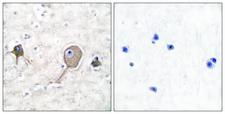 ENO2 / NSE Antibody - Peptide - + Immunohistochemical analysis of paraffin-embedded human brain tissue using NSE antibody.