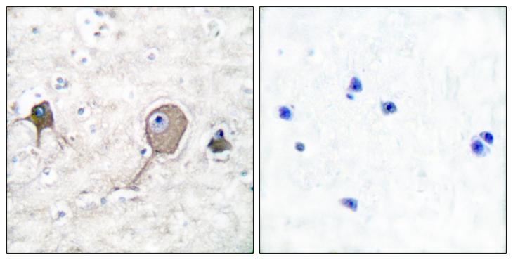 ENO2 / NSE Antibody - Peptide - + Immunohistochemical analysis of paraffin-embedded human brain tissue using NSE antibody.