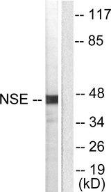 ENO2 / NSE Antibody - Western blot analysis of extracts from HepG2 cells, using NSE antibody.