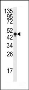 ENO2 / NSE Antibody - Western blot of anti-NSE Antibody (Y236) in Y79 cell line lysates (35 ug/lane). NSE (arrow) was detected using the purified antibody.