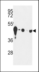ENO2 / NSE Antibody - Western blot of NSE-Y25 Antibody in mouse cerebellum tissue and Y79, HepG2, Jurkat, CEM cell line lysates (35 ug/lane). NSE (arrow) was detected using the purified antibody.