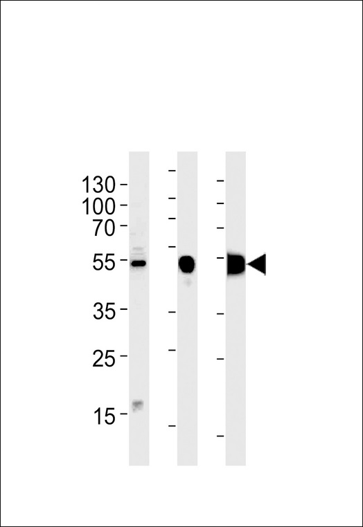ENO3 / Enolase 3 Antibody - ENOB Antibody western blot of RD cell line and mouse skeletal muscle,rat skeletal muscle lysates (35 ug/lane). The ENOB antibody detected the ENOB protein (arrow).