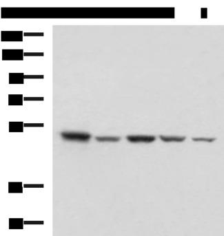 ENO3 / Enolase 3 Antibody - Western blot analysis of HepG2 NIH/3T3 C2CL2 Raji and Jurkat cell lysates  using ENO3 Polyclonal Antibody at dilution of 1:1000
