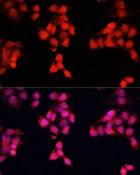 ENO3 / Enolase 3 Antibody - Immunofluorescence analysis of HeLa cells using ENO3 Polyclonal Antibody at dilution of 1:100.Blue: DAPI for nuclear staining.