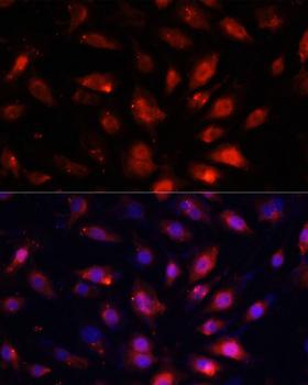 ENO3 / Enolase 3 Antibody - Immunofluorescence analysis of NIH/3T3 cells using ENO3 Polyclonal Antibody at dilution of 1:100.Blue: DAPI for nuclear staining.