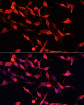 ENO3 / Enolase 3 Antibody - Immunofluorescence analysis of PC12 cells using ENO3 Polyclonal Antibody at dilution of 1:100.Blue: DAPI for nuclear staining.