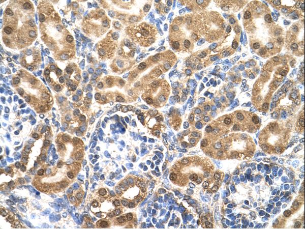 ENO3 / Enolase 3 Antibody - ENO3 antibody ENO3(enolase 3 (beta, muscle)) Antibody was used in IHC to stain formalin-fixed, paraffin-embedded human kidney.  This image was taken for the unconjugated form of this product. Other forms have not been tested.