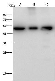 ENO3 / Enolase 3 Antibody - Anti-ENO3 rabbit polyclonal antibody at 1:500 dilution. Lane A: HepG2 Whole Cell Lysate. Lane B: Molt-4 Whole Cell Lysate. Lane C: NIH-3T3 Whole Cell Lysate. Lysates/proteins at 30 ug per lane. Secondary: Goat Anti-Rabbit IgG (H+L)/HRP at 1/10000 dilution. Developed using the ECL technique. Performed under reducing conditions. Predicted band size: 47 kDa. Observed band size: 47 kDa.