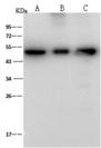 ENO3 / Enolase 3 Antibody - Anti-ENO3 rabbit polyclonal antibody at 1:500 dilution. Lane A: HepG2 Whole Cell Lysate. Lane B: Molt-4 Whole Cell Lysate. Lane C: NIH-3T3 Whole Cell Lysate. Lysates/proteins at 30 ug per lane. Secondary: Goat Anti-Rabbit IgG (H+L)/HRP at 1/10000 dilution. Developed using the ECL technique. Performed under reducing conditions. Predicted band size: 47 kDa. Observed band size: 47 kDa.