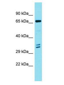 ENO4 Antibody - ENO4 antibody Western Blot of 721_B. Antibody dilution: 1 ug/ml.  This image was taken for the unconjugated form of this product. Other forms have not been tested.