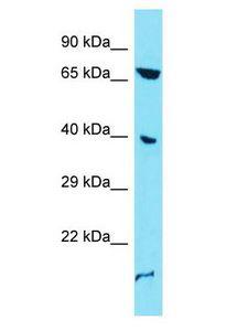 ENO4 Antibody - ENO4 antibody Western Blot of A549. Antibody dilution: 1 ug/ml.  This image was taken for the unconjugated form of this product. Other forms have not been tested.