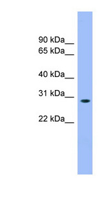 ENOPH1 / MASA Antibody - ENOPH1 / MASA antibody Western blot of Fetal liver lysate. This image was taken for the unconjugated form of this product. Other forms have not been tested.
