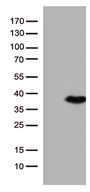 ENOPH1 / MASA Antibody - HEK293T cells were transfected with the pCMV6-ENTRY control. (Left lane) or pCMV6-ENTRY ENOPH1. (Right lane) cDNA for 48 hrs and lysed. Equivalent amounts of cell lysates. (5 ug per lane) were separated by SDS-PAGE and immunoblotted with anti-ENOPH1. (1:500)