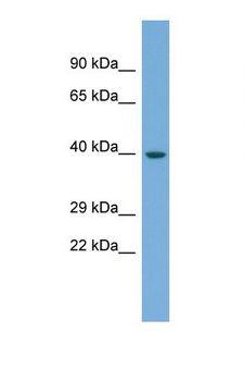 ENOSF1 Antibody - Western blot of Human Fetal Muscle. ENOSF1 antibody dilution 1.0 ug/ml.  This image was taken for the unconjugated form of this product. Other forms have not been tested.