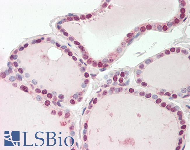 ENOSF1 Antibody - Human Thyroid: Formalin-Fixed, Paraffin-Embedded (FFPE).  This image was taken for the unconjugated form of this product. Other forms have not been tested.