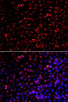 ENOX2 Antibody - Immunofluorescence analysis of U20S cells.