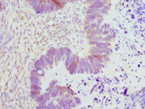 ENOX2 Antibody - Immunohistochemistry of paraffin-embedded human ovarian cancer at dilution 1:100