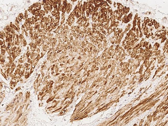 ENOX2 Antibody - Immunochemical staining of human ENOX2 in human smooth muscle with rabbit polyclonal antibody at 1:100 dilution, formalin-fixed paraffin embedded sections.