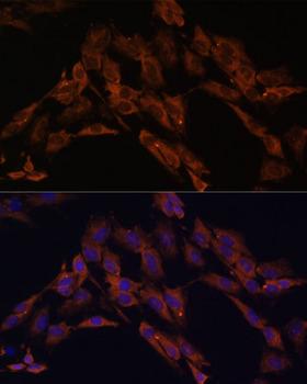 ENOX2 Antibody - Immunofluorescence analysis of C6 cells using ENOX2 Polyclonal Antibody at dilution of 1:100.Blue: DAPI for nuclear staining.