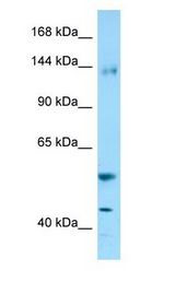 ENPEP / Aminopeptidase A Antibody - ENPEP / Aminopeptidase A antibody Western Blot of Fetal Brain.  This image was taken for the unconjugated form of this product. Other forms have not been tested.