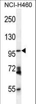 ENPEP / Aminopeptidase A Antibody - ENPEP Antibody western blot of NCI-H460 cell line lysates (35 ug/lane). The ENPEP antibody detected the ENPEP protein (arrow).