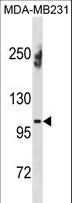 ENPP1 Antibody - ENPP1 Antibody western blot of MDA-MB231 cell line lysates (35 ug/lane). The ENPP1 antibody detected the ENPP1 protein (arrow).