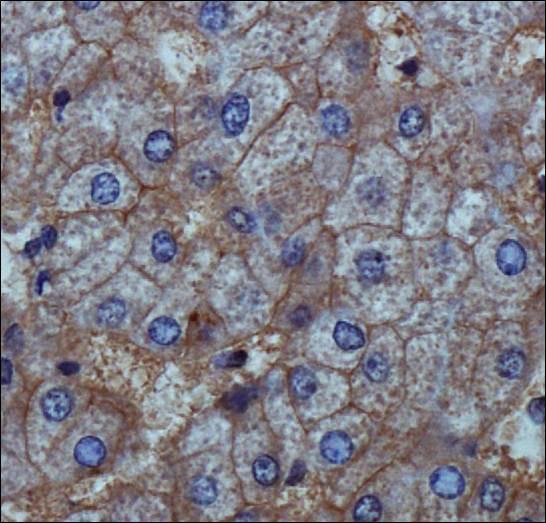 ENPP1 Antibody - Immunohistochemistry: ENPP1 Antibody - ENPP1 antibody was tested in human liver using DAB with hematoxylin counterstain.  This image was taken for the unconjugated form of this product. Other forms have not been tested.