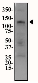 ENPP1 Antibody - Western Blot: ENPP-1 Antibody - Western blot analysis of ENPP-1 in HepG2 cell lysate at 2.0 ug/ml.  This image was taken for the unconjugated form of this product. Other forms have not been tested.