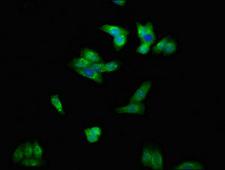 ENPP1 Antibody - Immunofluorescent analysis of HepG2 cells at a dilution of 1:100 and Alexa Fluor 488-congugated AffiniPure Goat Anti-Rabbit IgG(H+L)