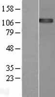 ENPP1 Protein - Western validation with an anti-DDK antibody * L: Control HEK293 lysate R: Over-expression lysate