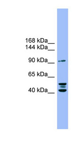 ENPP2 / Autotaxin Antibody - ENPP2 / Autotaxin antibody western blot of COLO205 cell lysate.  This image was taken for the unconjugated form of this product. Other forms have not been tested.