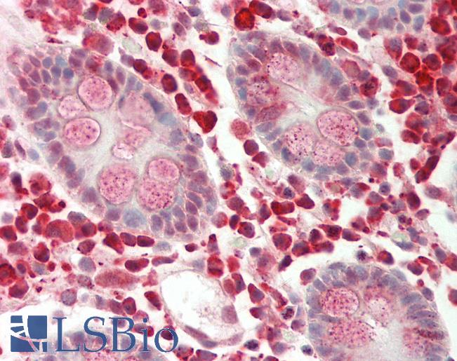 ENPP2 / Autotaxin Antibody - Human Colon: Formalin-Fixed, Paraffin-Embedded (FFPE).  This image was taken for the unconjugated form of this product. Other forms have not been tested.