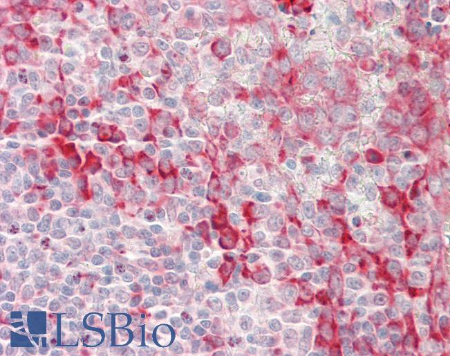 ENPP2 / Autotaxin Antibody - Human Tonsil: Formalin-Fixed, Paraffin-Embedded (FFPE).  This image was taken for the unconjugated form of this product. Other forms have not been tested.