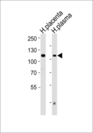 ENPP2 / Autotaxin Antibody - Western blot of lysates from human placenta and plasma tissue lysate (from left to right), using ENPP2 Antibody. Antibody was diluted at 1:1000 at each lane. A goat anti-rabbit IgG H&L (HRP) at 1:5000 dilution was used as the secondary antibody. Lysates at 35ug per lane.