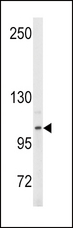 ENPP2 / Autotaxin Antibody - Western blot of anti-ENPP2 Antibody (Center K416) in Y79 cell line lysates (35 ug/lane). ENPP2(arrow) was detected using the purified antibody.