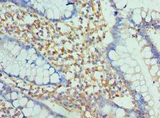 ENPP2 / Autotaxin Antibody - Immunohistochemistry of paraffin-embedded human small intestine using antibody at 1:100 dilution.