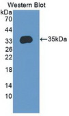 ENPP2 / Autotaxin Antibody - Western Blot; Sample: Recombinant protein.