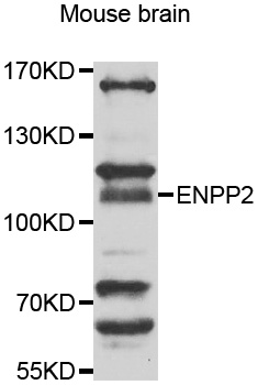 ENPP2 / Autotaxin Antibody - Western blot of extracts of mouse brain, using ENPP2 antibody.