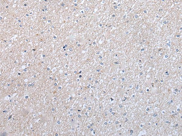 ENPP2 / Autotaxin Antibody - Immunohistochemistry of paraffin-embedded Human brain tissue  using ENPP2 Polyclonal Antibody at dilution of 1:50(×200)