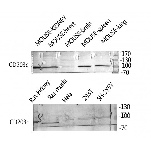 ENPP3 / CD203c Antibody - Western blot of CD203c antibody