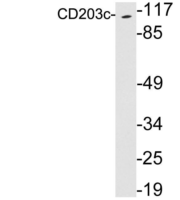 ENPP3 / CD203c Antibody - Western blot analysis of lysates from Jurkat cells, using CD203c antibody.