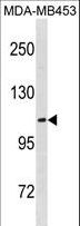 ENPP3 / CD203c Antibody - ENPP3 Antibody western blot of MDA-MB453 cell line lysates (35 ug/lane). The ENPP3 antibody detected the ENPP3 protein (arrow).