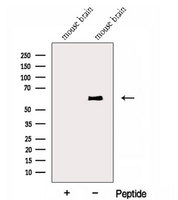 ENPP4 Antibody - Western blot analysis of extracts of mouse brain tissue using ENPP4 antibody. The lane on the left was treated with blocking peptide.
