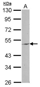 ENPP6 Antibody - Sample (30 ug of whole cell lysate) A: MCF-7 10% SDS PAGE ENPP6 antibody diluted at 1:1000